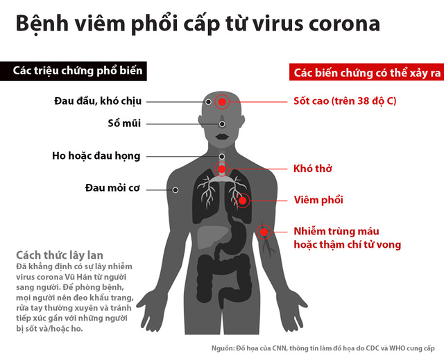 Các triệu chứng khi nhiễm virus corona